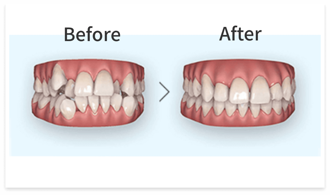 シミュレーション無料